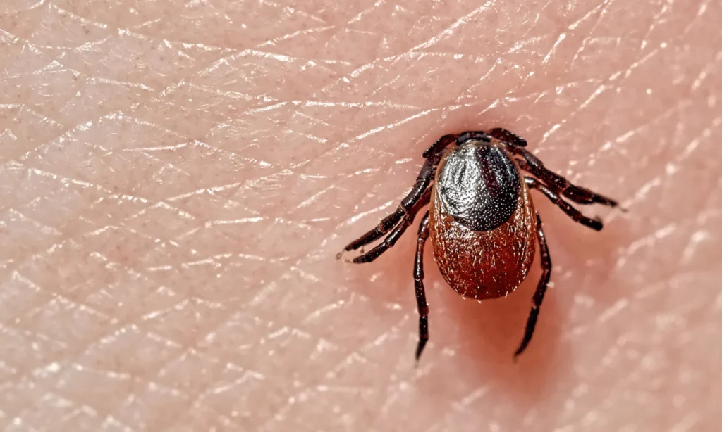 Lyme Disease