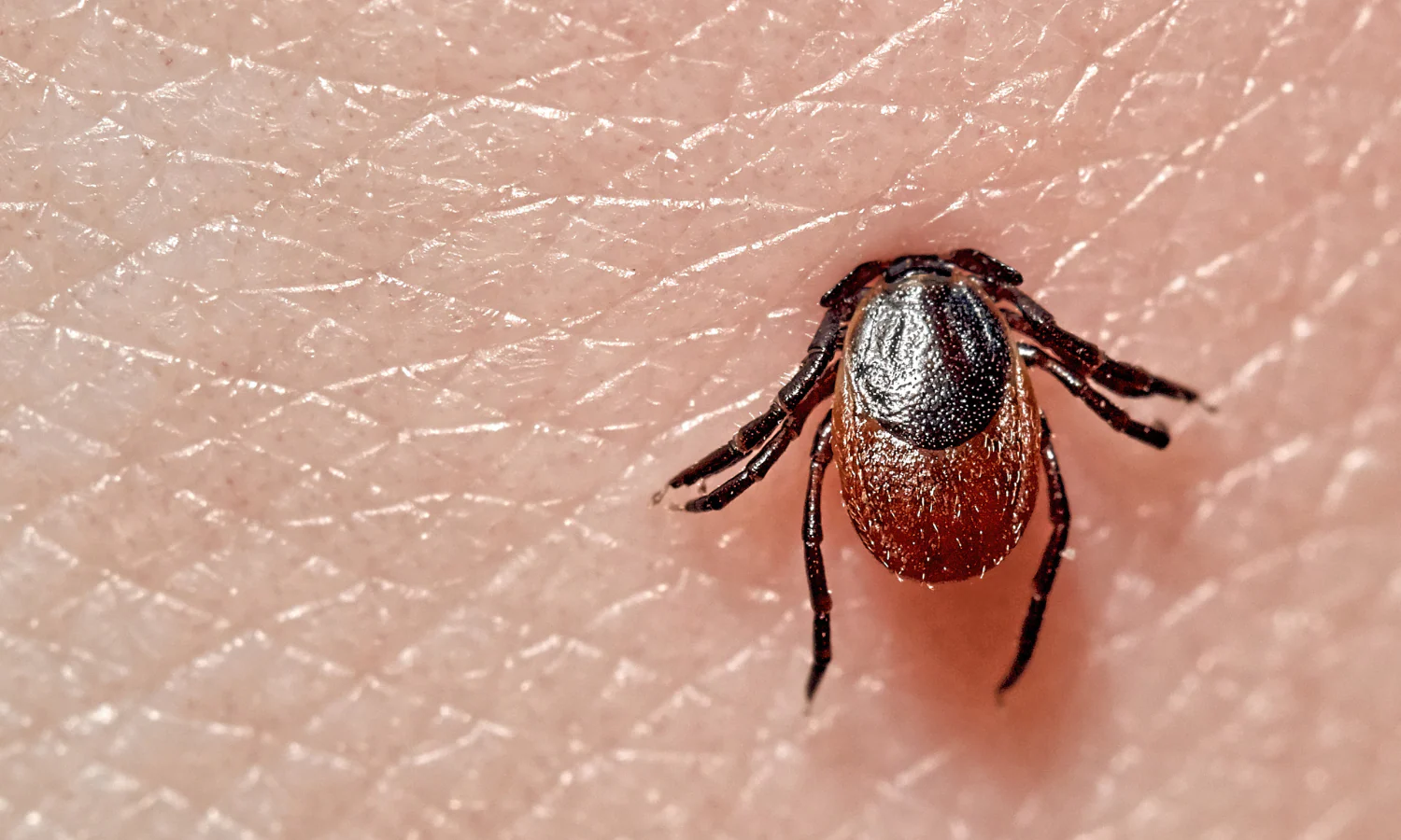 Lyme Disease